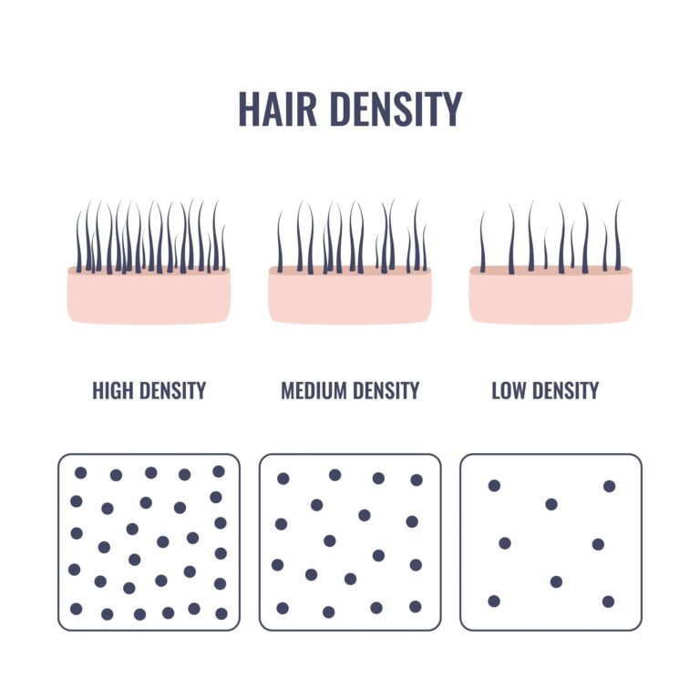 High-Density vs. Low-Density Areas