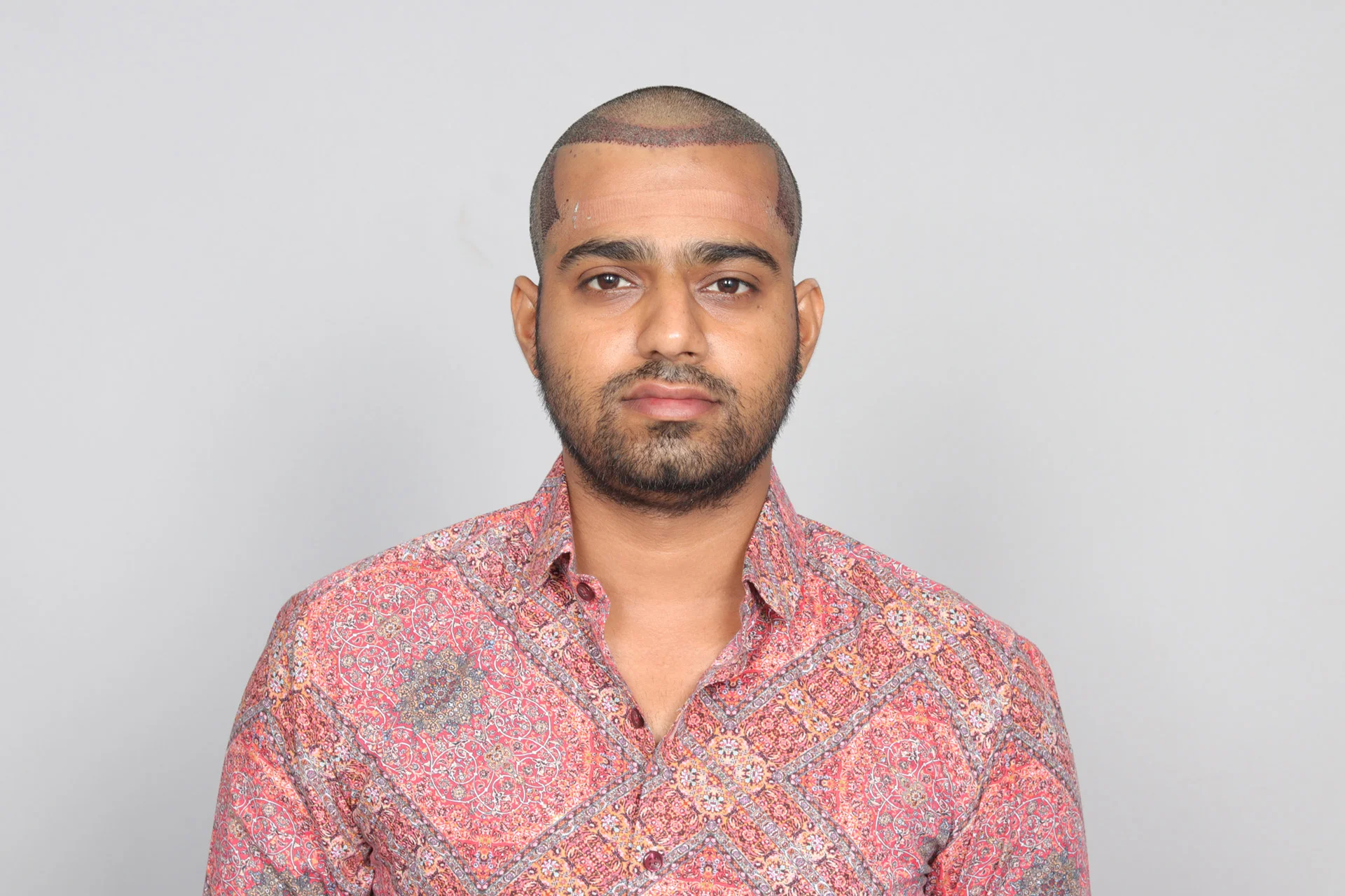 Result Image