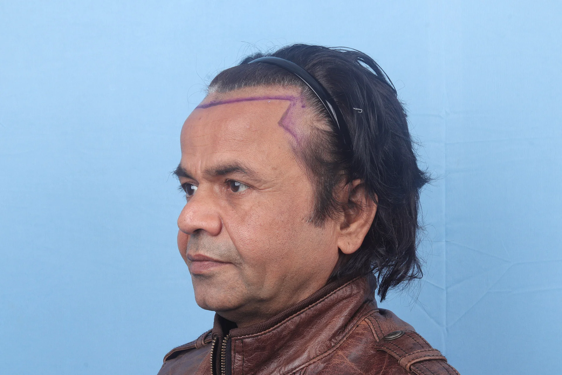 Result Image