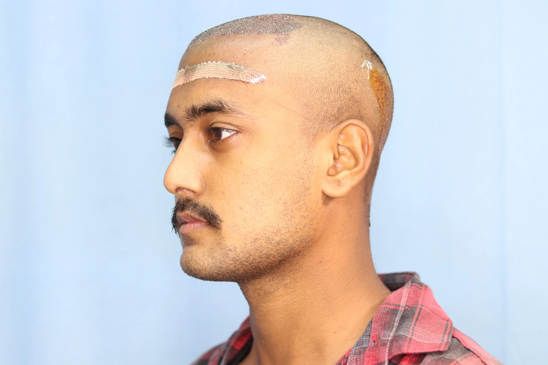 Result Image