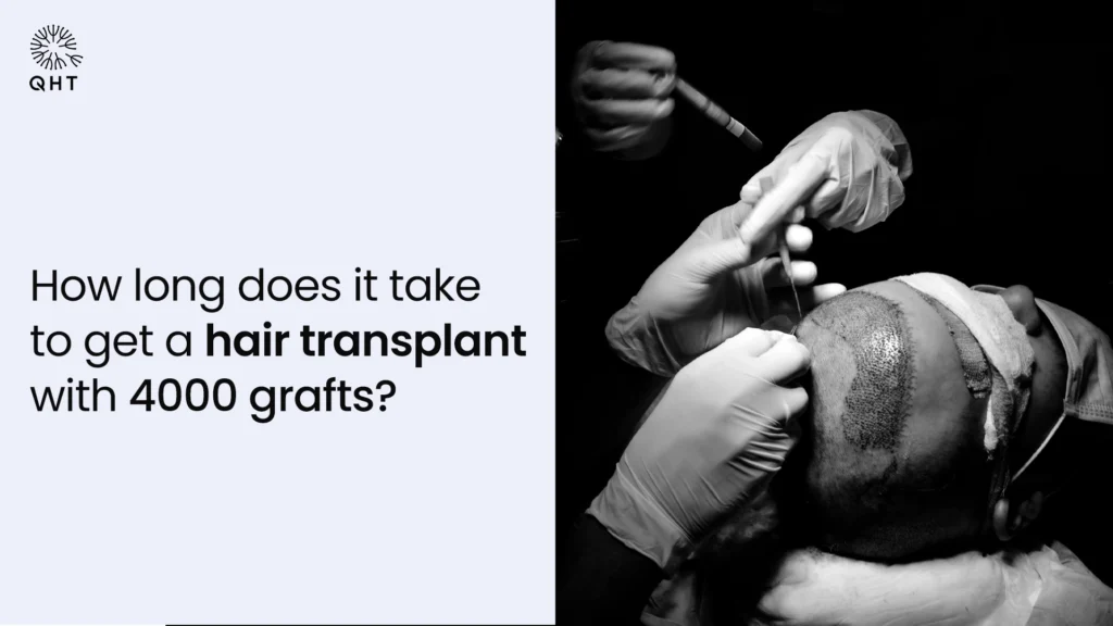 Close-up of a patient undergoing a 4000-graft hair transplant procedure to show the time and skill required for a large session.