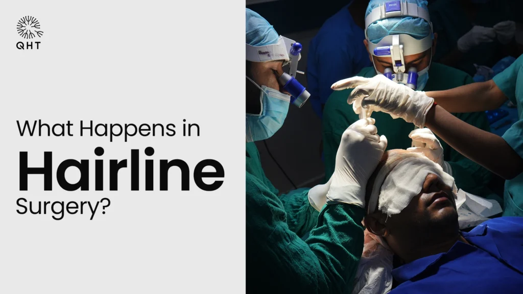 Surgeons in medical scrubs and magnifying loupes performing a precision hairline transplant on a patient at QHT clinic.