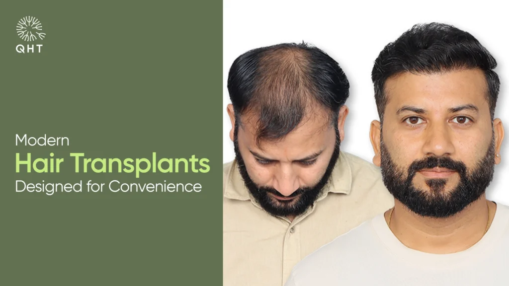 Surgeons at QHT Clinic performing a quick hair transplant using advanced FUE extraction technology and precise follicle implantation.