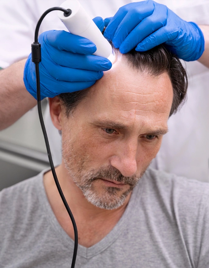 How to Choose a Hair Transplant Doctor in Delhi?