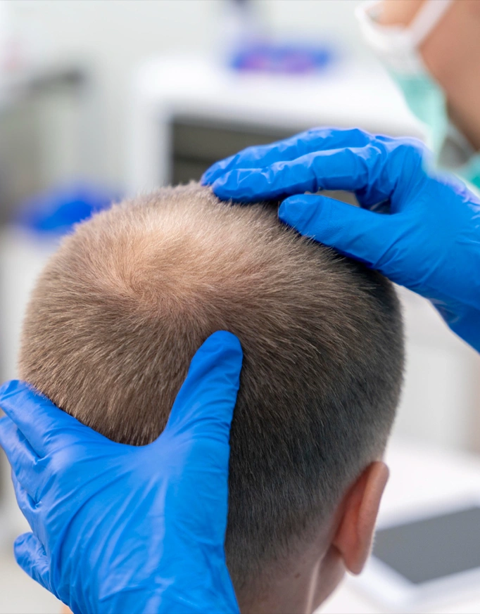 Medical Treatments That Support Hair Transplant Success