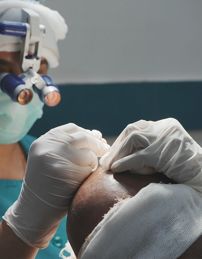 Which hair transplant technique is best?