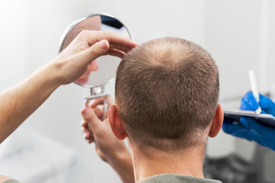 Crown hair growth
