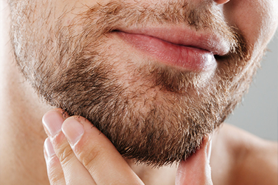Facial Hair Transplant