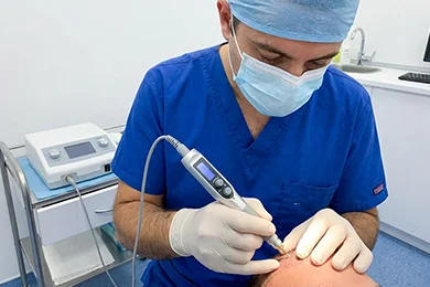 Motorised FUE Extraction