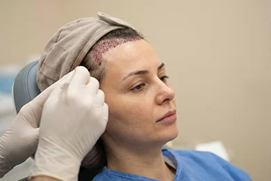 Natural Hairline Design