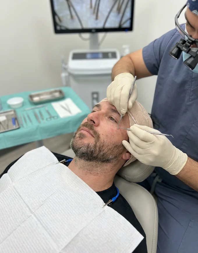 Beard Transplant Cost in Gurgaon – 2026 Pricing