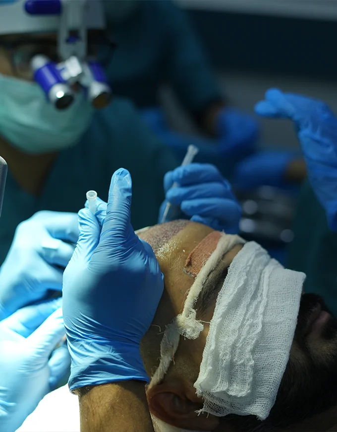 Why QHT Is the Top FUE Clinic in Gurgaon